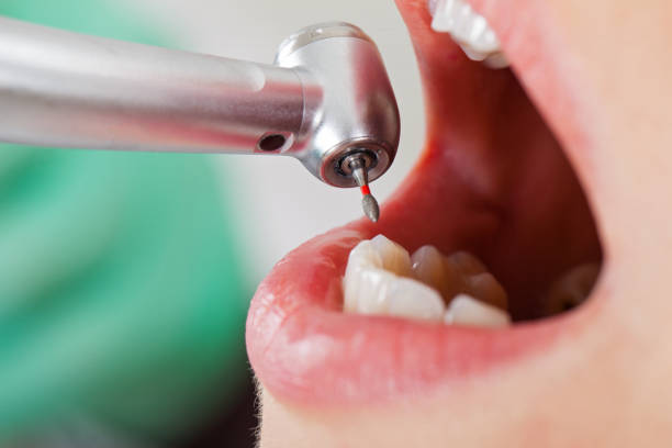 Best Urgent Care for Lost Fillings or Crowns in Slater, IA